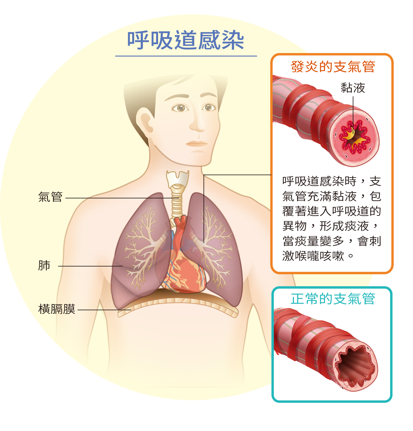 痰液的成因與人體免疫反應關係