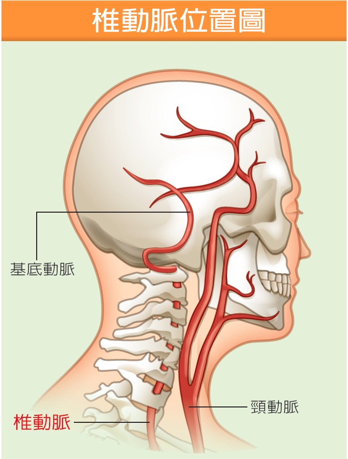 vertebralarterys