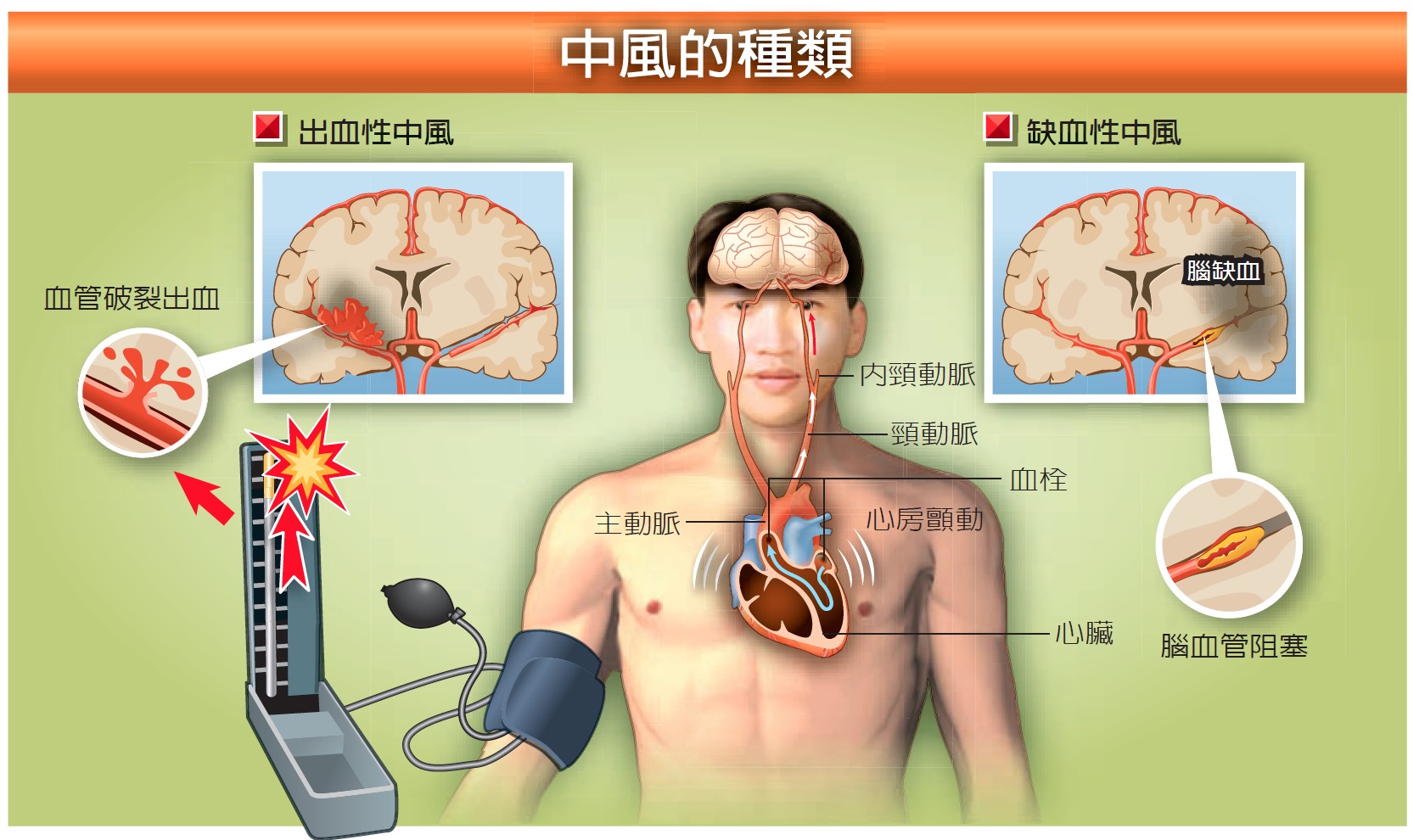 stroketype