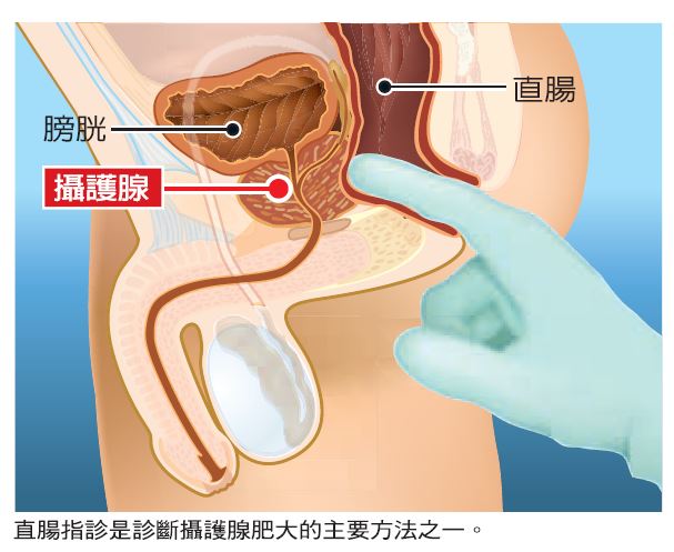 後 血尿 射精