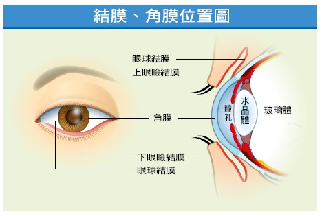 症 無 眼球